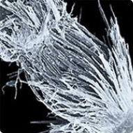 Cuticula desprinsă și aspră