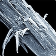 Cuticula ruptă și desprinsă